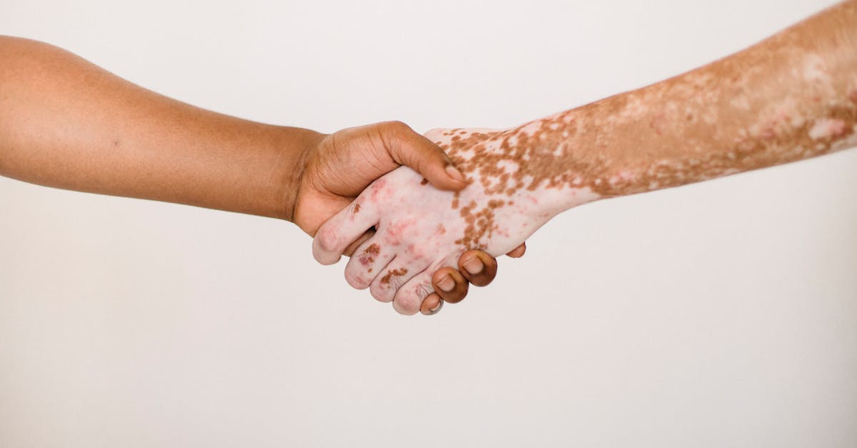 découvrez l'importance de l'intégration sociale : un processus essentiel qui favorise la cohésion et l'égalité au sein de la société, en facilitant l'inclusion des individus de toutes origines et en valorisant la diversité.